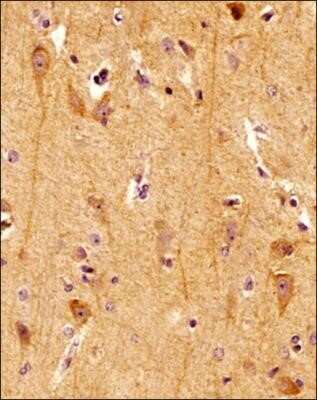 Immunohistochemistry: Spectrin beta 3 Antibody (1287A) - Azide and BSA Free [NBP2-80958] - IHC analysis of a formalin fixed paraffin embedded (FFPE) tissue section of human brain using Spectrin beta III antibody at a 1:1,000 dilution. The primary antibody bound to Spectrin beta III was detected with HRP-DAB detection method and the nuclei were