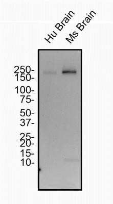 Western Blot: Spectrin beta 3 Antibody (1287A) - Azide and BSA Free [NBP2-80958] - Total protein from Human and Mouse Brain was separated on a 7.5% gel by SDS-PAGE, transferred to PVDF membrane and blocked in 5% non-fat milk in TBST. The membrane was probed with 2.0 ug/ml anti-Spectrin Beta III in blocking buffer and detected with an anti-rabbit HRP secondary antibody using chemiluminescence. Image from the standard format of this antibody.