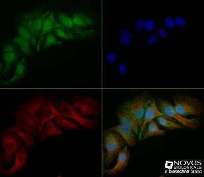 Immunocytochemistry/Immunofluorescence: Spectrin beta 3 Antibody (1287A) [NBP2-59668] - HeLa cells were fixed for 10 minutes using 10% formalin and then permeabilized for 5 minutes using 1X TBS + 0.5% Triton-X100. The cells were incubated with anti-Spectrin beta 3 (1287A) at 5.0ug/ml overnight at 4C and detected with an anti-rabbit Dylight 488 (Green) at a 1:500 dilution. Alpha tubulin (DM1A) NB100-690 was used as a co-stain at a 1:1000 dilution and detected with an anti-mouse Dylight 550 (Red) at a 1:500 dilution. Nuclei were counterstained with DAPI (Blue). Cells were imaged using a 40X objective.