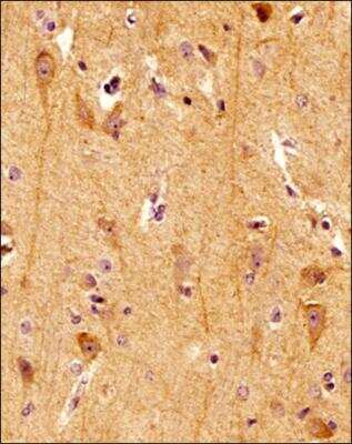 Immunohistochemistry-Paraffin: Spectrin beta 3 Antibody (1287A) [NBP2-59668] - IHC analysis of a formalin fixed paraffin embedded (FFPE) tissue section of human brain using Spectrin beta III antibody at a 1:1,000 dilution. The primary antibody bound to Spectrin beta III was detected with HRP-DAB detection method and the nuclei were counterstained with hematoxylin. This Spectrin beta III antibody generated a specific cytoplasmic staining in all the cells with strongest signal in neuronal cells.