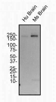 Western Blot: Spectrin beta 3 Antibody (1287A) [NBP2-59668] - Total protein from Human and Mouse Brain was separated on a 7.5% gel by SDS-PAGE, transferred to PVDF membrane and blocked in 5% non-fat milk in TBST. The membrane was probed with 2.0 ug/ml anti-Spectrin Beta III in blocking buffer and detected with an anti-rabbit HRP secondary antibody using chemiluminescence.