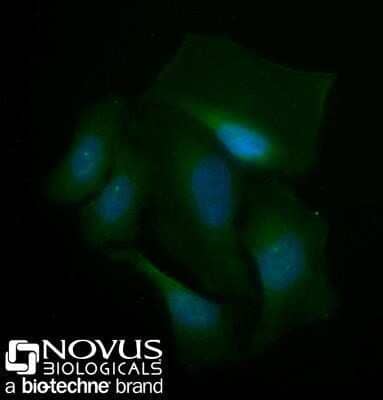 Immunocytochemistry/Immunofluorescence: Spectrin beta 3 Antibody (3B1NB) - Azide Free [NBP2-44311] - HeLa cells were fixed for 10 minutes using 10% formalin and then permeabilized for 5 minutes using 1X PBS + 0.05% Triton-X100. The cells were incubated with anti-Spectrin beta 3 (3B1NB) conjugated to Alexa Fluor 488 [NBP2-44310AF488] at 10ug/ml for 1 hour at room temperature. Nuclei were counterstained with DAPI (Blue). Cells were imaged using a 40X objective.