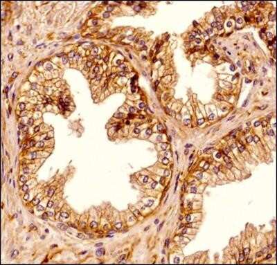 Immunohistochemistry-Paraffin: Spectrin beta 3 Antibody (3B1NB) - Azide Free [NBP2-44311] - IHC analysis of a formalin fixed and paraffin embedded tissue section of normal human prostate using 1:200 dilution of Spectrin beta 3 antibody (clone 3B1NB). The antibody generated a specific cytoplasmic staining with strong signal at cell-cell junctions in the glandular epithelium of the prostate section. The cells of fibromuscular stroma showed a diffused signal throughout the sections. Image using the standard format of this product.