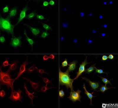 Immunocytochemistry/Immunofluorescence: Spectrin beta 3 Antibody [NB110-58783] - Spectrin beta 3 antibody was tested in Neuro 2A cells with DyLight 488 (green). Nuclei and alpha-tubulin were counterstained with DAPI (blue) and Dylight 550 (red).