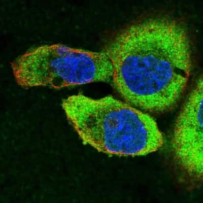 Immunocytochemistry/Immunofluorescence: Spectrin beta 3 Antibody [NBP2-48703] - Immunofluorescent staining of human cell line A-431 shows localization to cytosol.