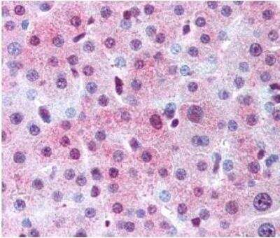 Immunohistochemistry: Spectrin beta 3 Antibody [NB110-58783] - Detection of Spectrin Beta-III in human hepatocytes using NB110-58783.