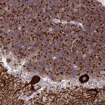 Immunohistochemistry-Paraffin: Spectrin beta 3 Antibody [NBP2-48703] - Staining of human cerebellum shows strong cytoplasmic positivity in Purkinje cells, granular and molecular layer cells.