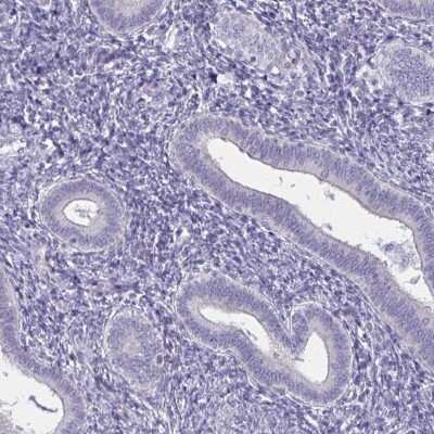 Immunohistochemistry-Paraffin: Spectrin beta 3 Antibody [NBP2-48703] - Staining of human endometrium shows low expression as expected.