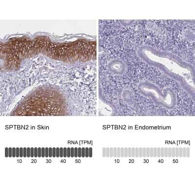 <b>Orthogonal Strategies Validation. </b>Immunohistochemistry-Paraffin: Spectrin beta 3 Antibody [NBP2-48703] - Staining in human skin and endometrium tissues using anti-SPTBN2 antibody. Corresponding SPTBN2 RNA-seq data are presented for the same tissues.