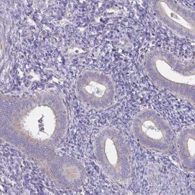 Immunohistochemistry-Paraffin: Spectrin beta 3 Antibody [NBP2-48794] - Staining of human endometrium shows low expression as expected.