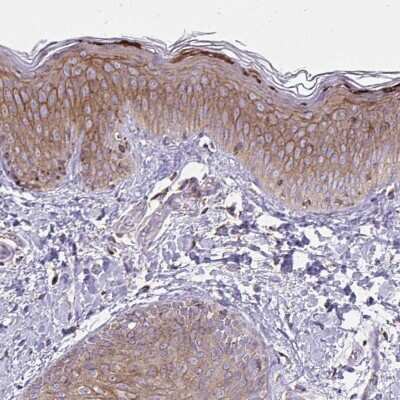 Immunohistochemistry-Paraffin: Spectrin beta 3 Antibody [NBP2-48794] - Staining of human skin shows high expression.