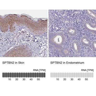 <b>Orthogonal Strategies Validation. </b>Immunohistochemistry-Paraffin: Spectrin beta 3 Antibody [NBP2-48794] - Staining in human skin and endometrium tissues using anti-SPTBN2 antibody. Corresponding SPTBN2 RNA-seq data are presented for the same tissues.