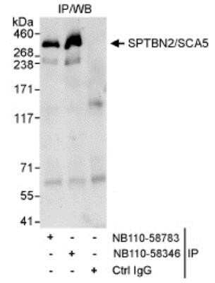 Immunoprecipitation: Spectrin beta 3 Antibody [NB110-58783] - Detection of Human SPTBN2/SCA5 by Western Blot of Immunoprecipitates. Samples: Whole cell lysate (1 mg for IP, 20% of IP loaded) from HeLa cells. Antibodies: Affinity purified rabbit anti-SPTBN2/SCA5 antibody NB110-58783 used for IP at 3 mcg/mg lysate. SPTBN2/SCA5 was also immunoprecipitated by rabbit anti-SPTBN2/SCA5 antibody NB110-58346, which recognizes a downstream epitope. Detection: Chemiluminescence with an exposure time of 30 seconds.