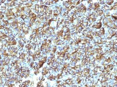 Immunohistochemistry-Paraffin: Spectrin beta 3 Antibody (SPTBN2/1247) [NBP2-53311] - Formalin-fixed, paraffin-embedded Human Pancreas stained with Spectrin beta III Monoclonal Antibody (SPTBN2/1247).