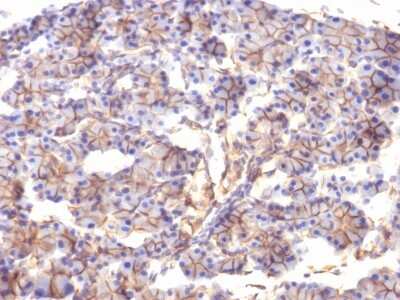 Immunohistochemistry-Paraffin: Spectrin beta 3 Antibody (SPTBN2/1247) [NBP2-53311] - Formalin-fixed, paraffin-embedded Rat Pancreas stained with Spectrin beta III Monoclonal Antibody (SPTBN2/1247).