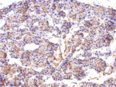 Immunohistochemistry-Paraffin: Spectrin beta 3 Antibody (SPTBN2/1247) [NBP2-54441] - Formalin-fixed, paraffin-embedded Rat Pancreas stained with Spectrin beta III Monoclonal Antibody (SPTBN2/1247).