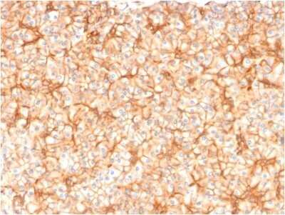 Immunohistochemistry-Paraffin: Spectrin beta 3 Antibody (SPTBN2/1582) - Azide and BSA Free [NBP2-54488] - Formalin-fixed, paraffin-embedded human Pancreas stained with Spectrin beta 3 Antibody (SPTBN2/1582).