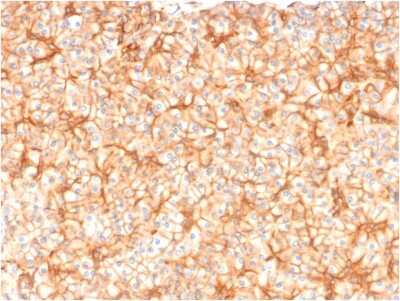 Immunohistochemistry-Paraffin: Spectrin beta 3 Antibody (SPTBN2/1582) [NBP2-53236] - Formalin-fixed, paraffin-embedded human Pancreas stained with Spectrin beta 3 Antibody (SPTBN2/1582).