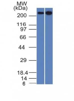 Western Blot: Spectrin beta 3 Antibody (SPTBN2/1582) [NBP2-53236] - Analysis of HeLa and 293 Cell Lysates using Spectrin beta III Monoclonal Antibody (SPTBN2/1582).