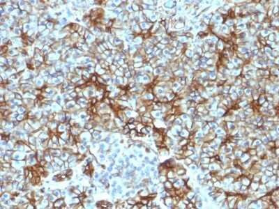 Immunohistochemistry-Paraffin: Spectrin beta 3 Antibody (SPTBN2/1583) [NBP2-53312] - Formalin-fixed, paraffin-embedded Human Pancreas stained with Spectrin beta III Monoclonal Antibody (SPTBN2/1583).