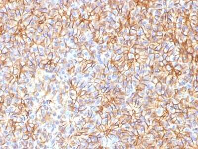 Immunohistochemistry-Paraffin: Spectrin beta 3 Antibody (SPTBN2/1584) [NBP2-53315] - Formalin-fixed, paraffin-embedded Human Pancreas stained with Spectrin beta III Monoclonal Antibody (SPTBN2/1584).