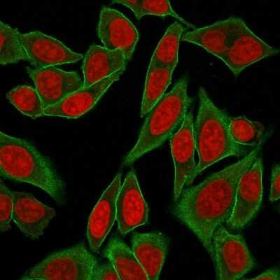 Immunocytochemistry/Immunofluorescence: Spectrin beta 3 Antibody (SPTBN2/2887R) [NBP3-07293] - Immunofluorescence Analysis of Human HeLa cells labeling SPTBN2 with Spectrin beta 3 Rabbit Recombinant Monoclonal (SPTBN2/2887R) followed by Goat anti- Mouse IgG-CF488 (Green). The nuclear counterstain is RedDot (Red).