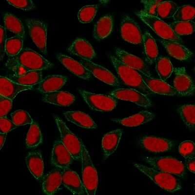 Immunocytochemistry/Immunofluorescence: Spectrin beta 3 Antibody (SPTBN2/3142R) - Azide and BSA Free [NBP3-08442] - Immunofluorescence Analysis of HeLa cells labeling Spectrin Beta III with Spectrin beta 3 Recombinant Rabbit Monoclonal (SPTBN2/3142R) followed by goat anti- Mouse IgG-CF488 (Green). Nuclear counterstain is RedDot (Red)