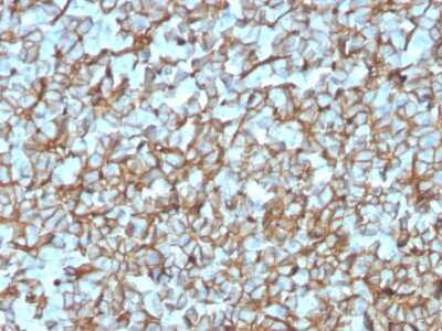 Immunohistochemistry-Paraffin: Spectrin beta 3 Antibody (SPTBN2/3142R) - Azide and BSA Free [NBP3-08442] - Formalin-fixed, paraffin-embedded human Pancreas stained with Spectrin beta 3 Recombinant Rabbit Monoclonal (SPTBN2/3142R).