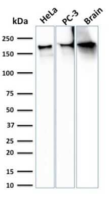 Western Blot: Spectrin beta 3 Antibody (SPTBN2/3142R) - Azide and BSA Free [NBP3-08442] - Western Blot Analysis of HeLa, PC-3 cells and Brain tissue lysate using Spectrin beta 3 Recombinant Rabbit Monoclonal (SPTBN2/3142R).