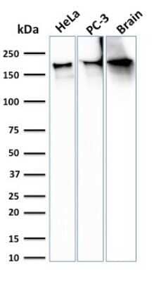 Western Blot: Spectrin beta 3 Antibody (SPTBN2/3142R) [NBP3-07294] - Western Blot Analysis of HeLa, PC-3 cells and Brain tissue lysate using Spectrin beta 3 Recombinant Rabbit Monoclonal (SPTBN2/3142R).