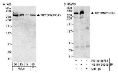 Western Blot: Spectrin beta 3 Antibody [NB110-58346] - Detection of Human Spectrin beta 3 on HeLa whole cell lysates using NB110-58346. Spectrin beta 3 was also immunoprecipitated by rabbit anti-Spectrin beta 3 antibody NB110-58783.