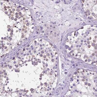 <b>Orthogonal Strategies Validation. </b>Immunohistochemistry-Paraffin: Speedy/Ringo Antibody [NBP2-49476] - Staining of human testis shows high expression.