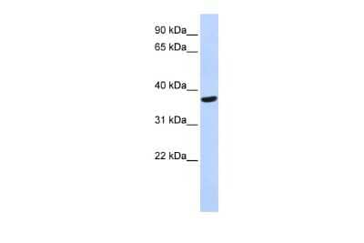 Western Blot: Speedy/Ringo Antibody [NBP2-88357] - WB Suggested Anti-SPDYA Antibody Titration: 0.2-1 ug/ml. ELISA Titer: 1:1562500. Positive Control: Human heart