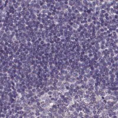Immunohistochemistry-Paraffin: Sperm Flagellar 2 Antibody [NBP2-38461] - Staining of human lymph node.