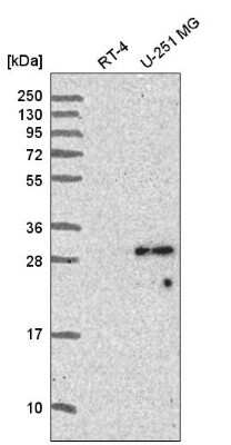 Western Blot: Sperm-associated antigen 7 Antibody [NBP2-56171] - Western blot analysis in human cell line RT-4 and human cell line U-251 MG.