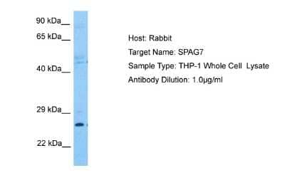 Western Blot: Sperm-associated antigen 7 Antibody [NBP2-85809] - Host: Rabbit. Target Name: SPAG7. Sample Tissue: Human THP-1 Whole Cell. Antibody Dilution: 1.0ug/ml