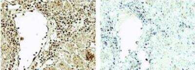 Immunohistochemistry: Spermidine Antibody [NB100-1847] - Staining of rat lungs. Right image is tissue without primary antibody.