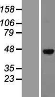 Western Blot: Sphingosine Kinase 1 Overexpression Lysate (Adult Normal) [NBP2-06490] Left-Empty vector transfected control cell lysate (HEK293 cell lysate); Right -Over-expression Lysate for Sphingosine Kinase 1.