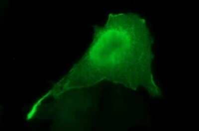 Immunocytochemistry/Immunofluorescence: Sphingosine Kinase 1/SPHK1 Antibody (OTI1A6) - Azide and BSA Free [NBP2-74332] - Analysis  of COS7 cells transiently transfected by pCMV6-ENTRY Sphingosine Kinase 1/SPHK1.