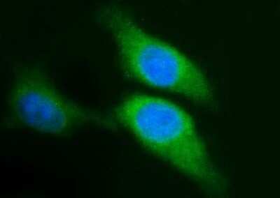 Immunocytochemistry/Immunofluorescence: Sphingosine Kinase 1/SPHK1 Antibody (OTI1A6) - Azide and BSA Free [NBP2-74332] - Analysis of HeLa cells.