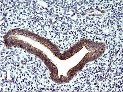 Immunohistochemistry: Sphingosine Kinase 1/SPHK1 Antibody (OTI1A6) - Azide and BSA Free [NBP2-74332] - Analysis of Human endometrium tissue. (Heat-induced epitope retrieval by 1 mM EDTA in 10mM Tris, pH8.5, 120C for 3min)