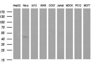 Western Blot: Sphingosine Kinase 1/SPHK1 Antibody (OTI1A6) - Azide and BSA Free [NBP2-74332] - Analysis of extracts (35ug) from 9 different cell lines (HepG2: human; HeLa: human; SVT2: mouse; A549: human; COS7: monkey; Jurkat: human; MDCK: canine; PC12: rat; MCF7: human).