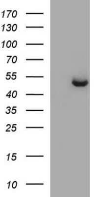 Western Blot: Sphingosine Kinase 1/SPHK1 Antibody (OTI1A6) - Azide and BSA Free [NBP2-74332] - Analysis of HEK293T cells were transfected with the pCMV6-ENTRY control (Left lane) or pCMV6-ENTRY SPHK1.