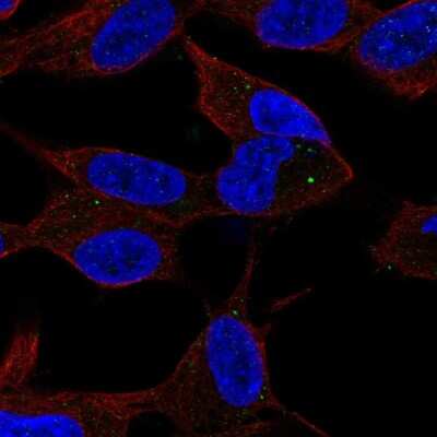 Immunocytochemistry/Immunofluorescence: Sphingosine Kinase 2/SPHK2 Antibody [NBP2-57035] - Staining of human cell line SH-SY5Y shows localization to vesicles.