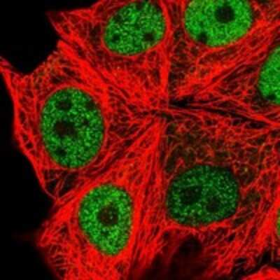 Immunocytochemistry/Immunofluorescence: Sphingosine Kinase 2/SPHK2 Antibody [NBP3-17771] - Staining of human cell line MCF7 shows localization to nucleoplasm.