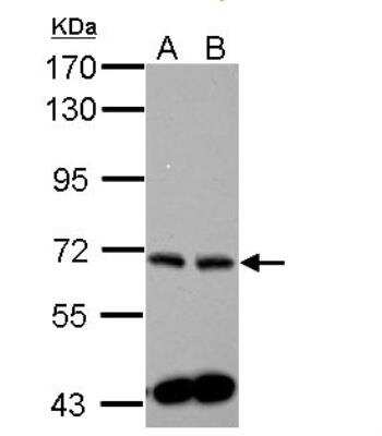 Western Blot: Sphingosine Kinase 2/SPHK2 Antibody [NBP1-33085] - Sample (30 ug of whole cell lysate) A: PC-3 B: U87-MG   7.5% SDS PAGE diluted at 1:1000