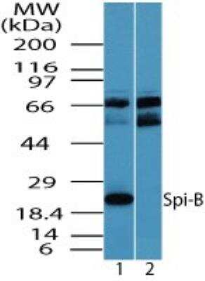Western Blot: Spi-B Antibody [NBP2-24625] - Analysis of Spi-B in human spleen lysate in the 1) absence and 2) presence of immunizing peptide using this antibody. 0 ug/ml.
