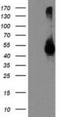 Western Blot: Spinesin Antibody (OTI4A11) - Azide and BSA Free [NBP2-74333] - HEK293T cells were transfected with the pCMV6-ENTRY control (Left lane) or pCMV6-ENTRY Spinesin (Right lane) cDNA for 48 hrs and lysed. Equivalent amounts of cell lysates (5 ug per lane) were separated by SDS-PAGE and immunoblotted with anti-Spinesin.