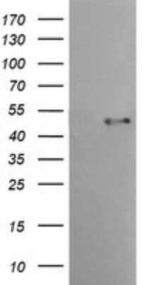 Western Blot: Spinesin Antibody (OTI4G4) - Azide and BSA Free [NBP2-74337] - Analysis of HEK293T cells were transfected with the pCMV6-ENTRY control (Left lane) or pCMV6-ENTRY Spinesin.