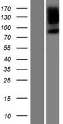 Western Blot PPP1R9B/Spinophilin Overexpression Lysate